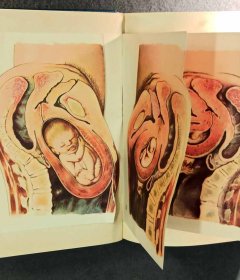 IMG_20240405_181033